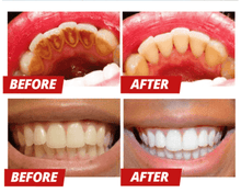 Load image into Gallery viewer, Viaty™ : Le dentifrice détachant Blanchissant.